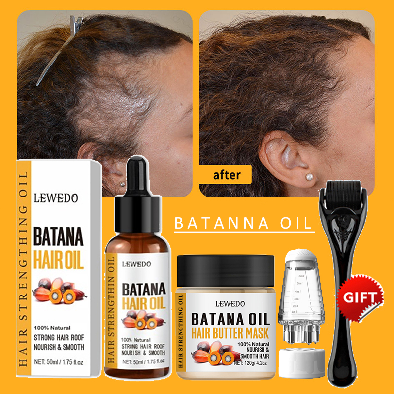 Hair Care Dupes - Batana Oil Hair Growth Kit Traction