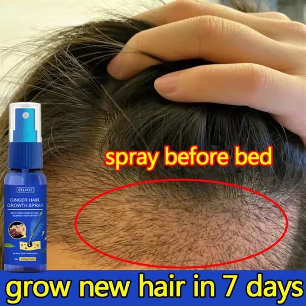 Hair Care Herbal - Ginger Hair Growth spray Anti Hair