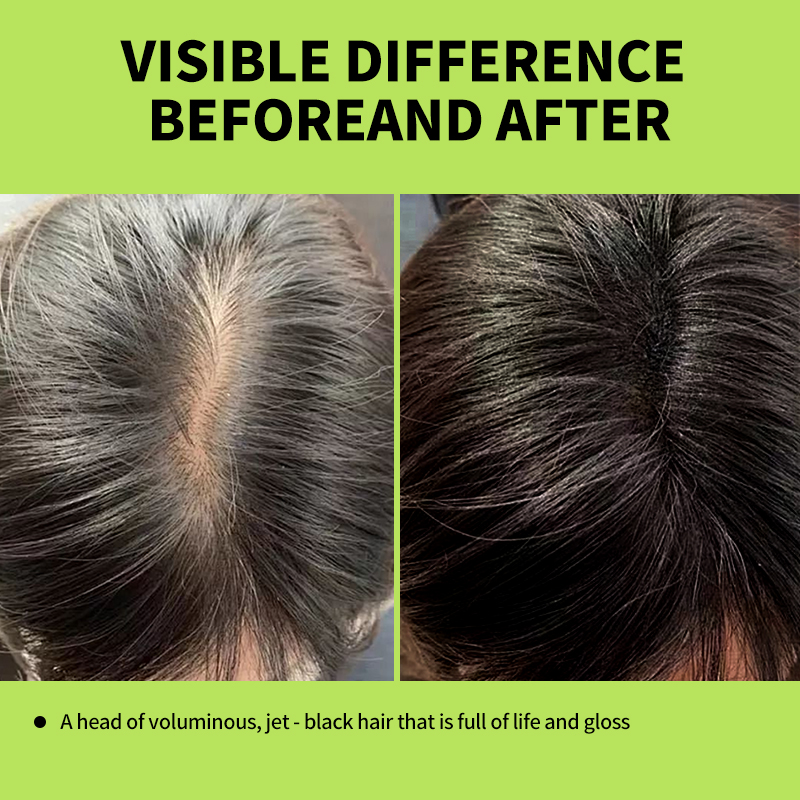 Green Apple Black Hair Dye Sha – Hair Care Herbal Bewertung und Preis