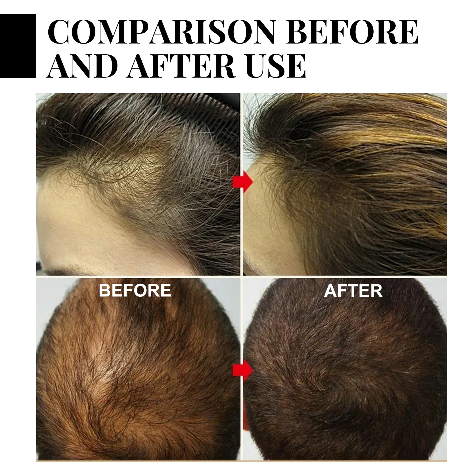 Ginger Hair Growth spray Anti  – Hair Care Herbal Bewertung und Preis