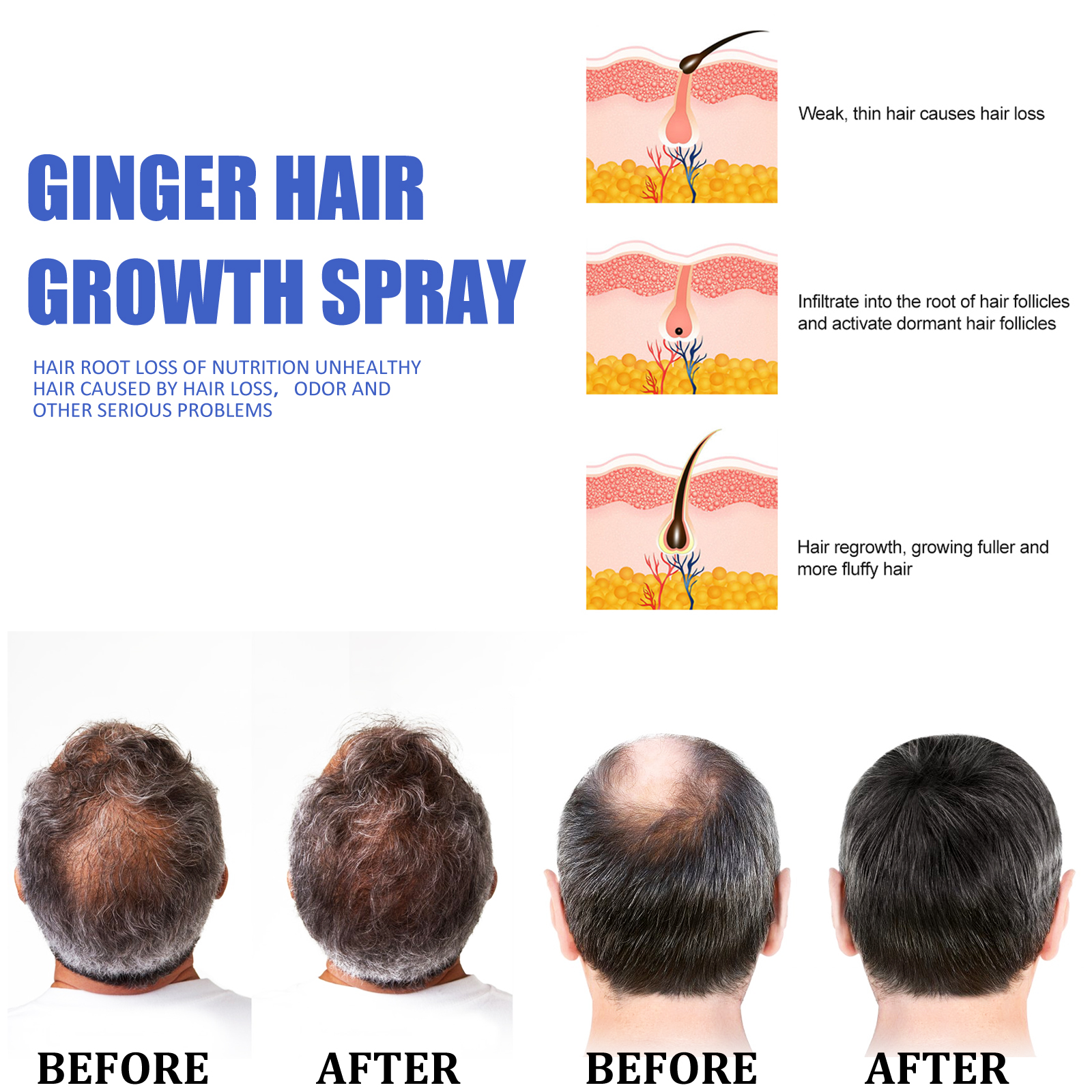 Ginger Hair Growth spray Anti  – Hair Care Herbal Bewertung und Preis